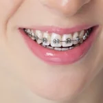 الألبوم الرابع